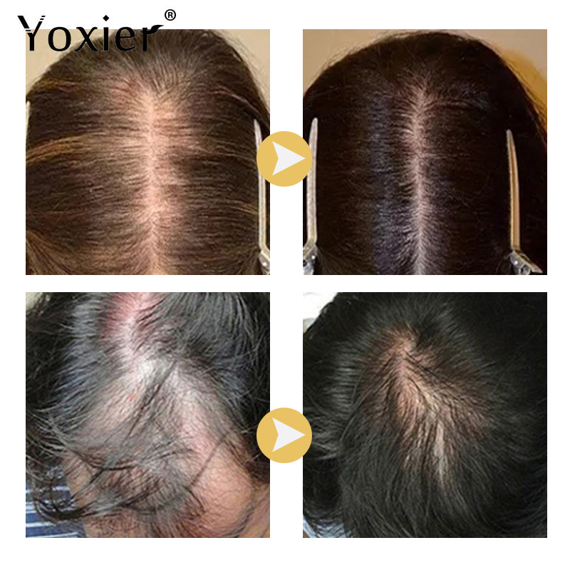 Intensive Growth Serum Prevent - Hair Care Treatment recension och pris