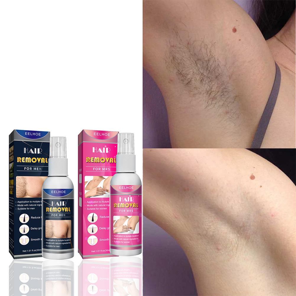 1/2PCS Super Natural Painless  - Hair Care China recension och pris
